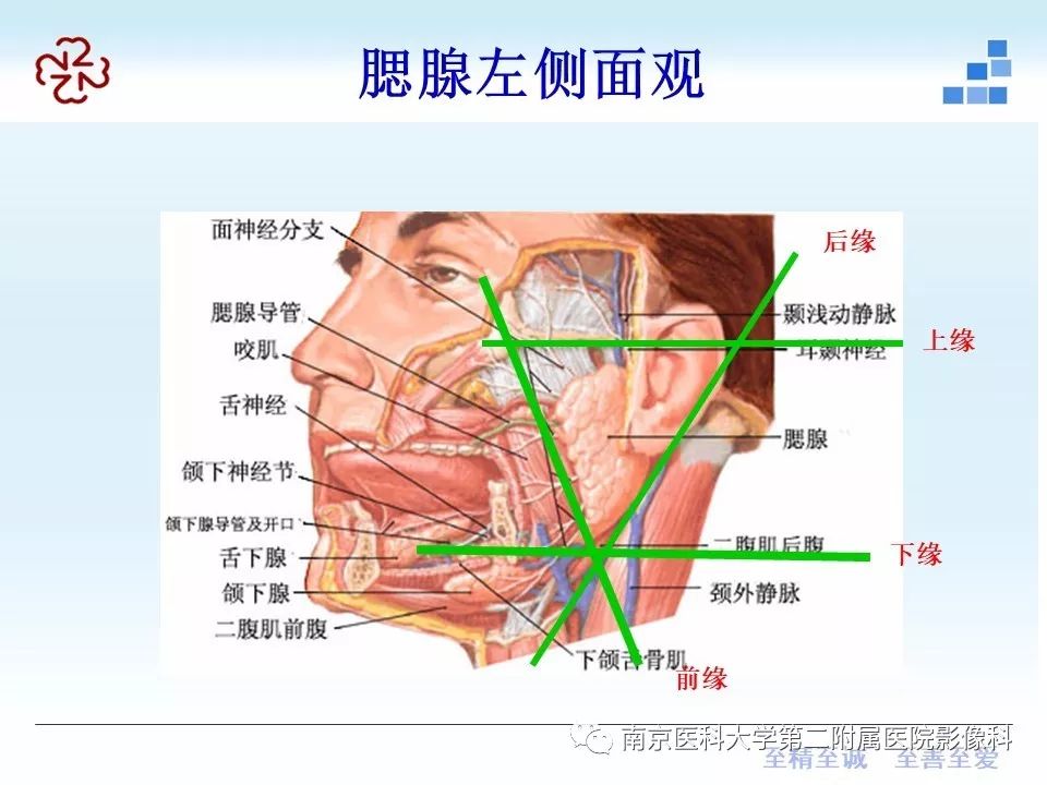 【PPT】腮腺腺淋巴瘤的影像学表现