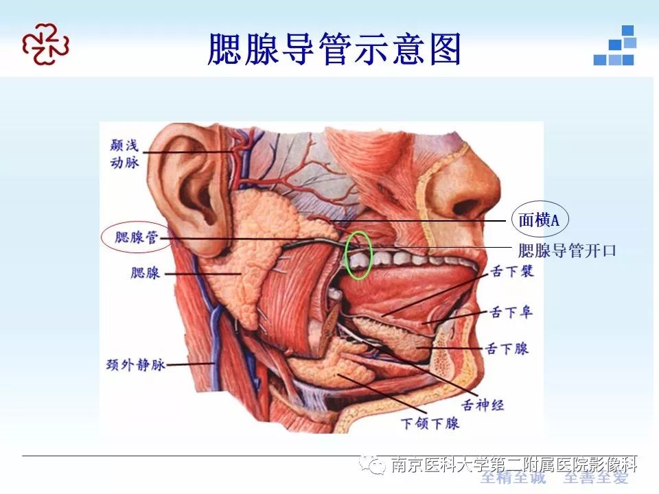 【PPT】腮腺腺淋巴瘤的影像学表现