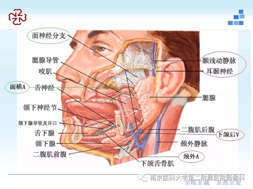 【PPT】腮腺腺淋巴瘤的影像学表现