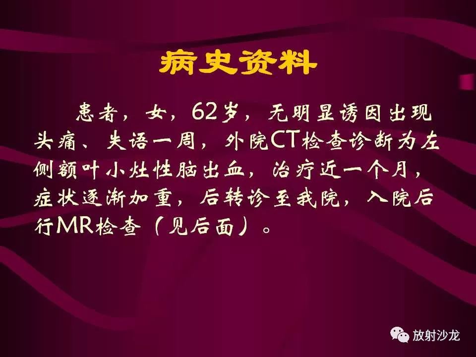 【病例】多形性胶质母细胞瘤1例CT及MR
