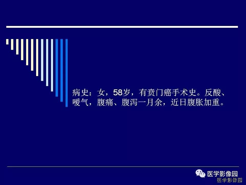 【病例】克罗恩病Crohn病1例CT