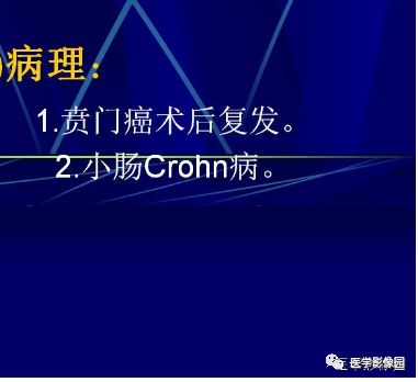 【病例】克罗恩病Crohn病1例CT