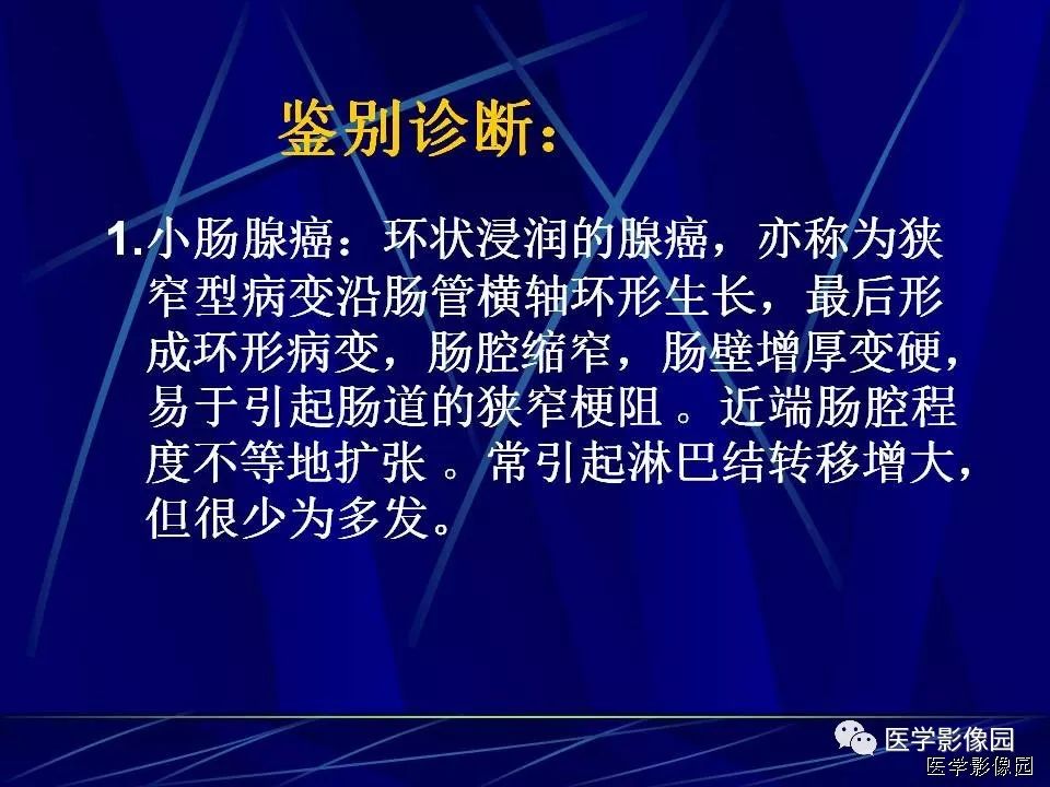 【病例】克罗恩病Crohn病1例CT