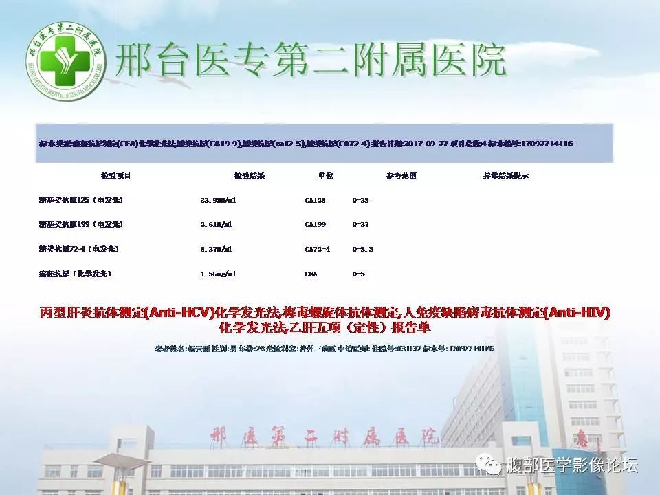 【病例】腹腔卵黄囊瘤1例CT影像表现 【病例】腹腔卵黄囊瘤1例CT影像表现