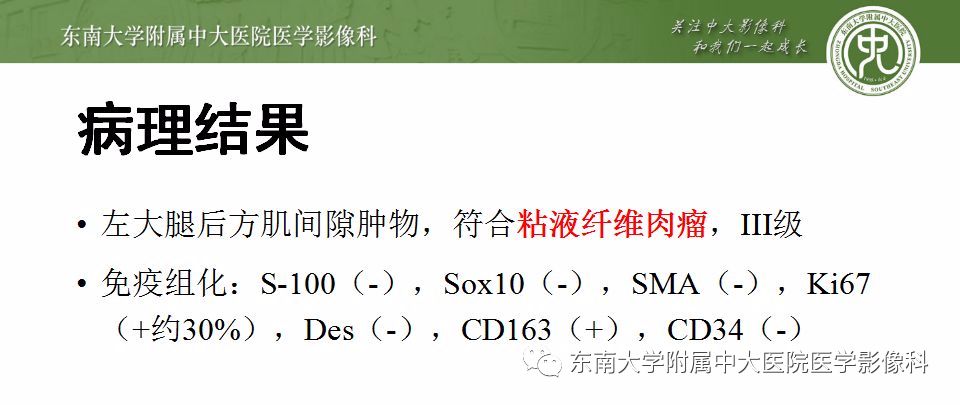 【病例】大腿黏液纤维肉瘤1例MR影像表现