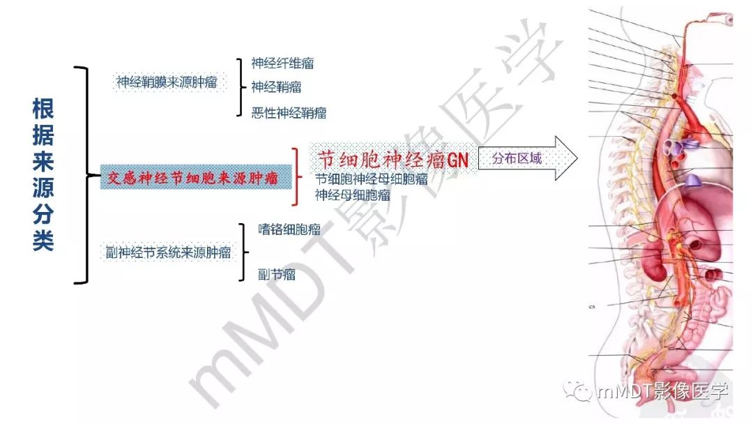 【PPT】节细胞神经瘤影像诊断
