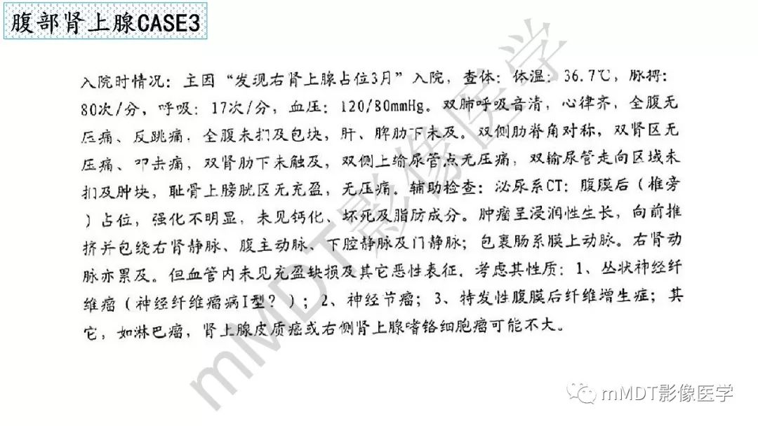 【PPT】节细胞神经瘤影像诊断