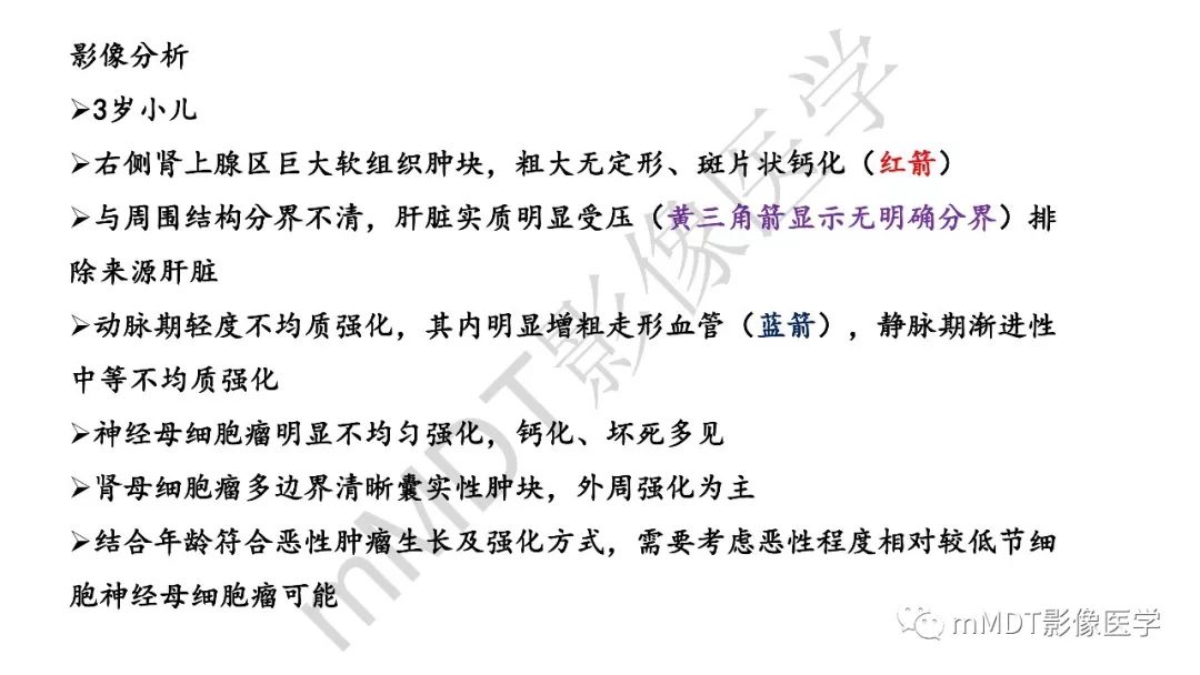 【PPT】节细胞神经瘤影像诊断