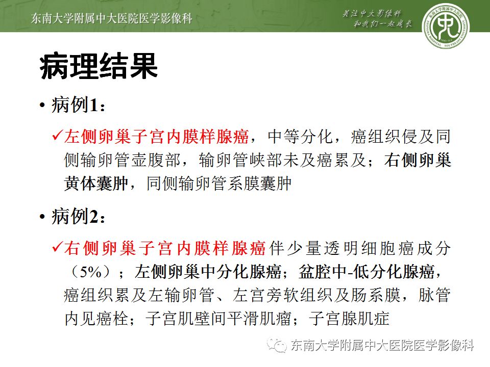 【病例】卵巢子宫内膜样癌2例MR影像表现