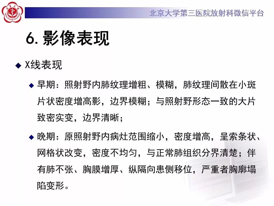 【病例】放射性肺损伤2例CT影像表现