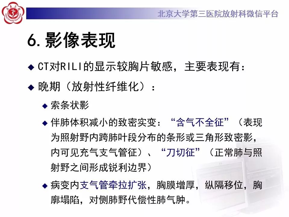 【病例】放射性肺损伤2例CT影像表现