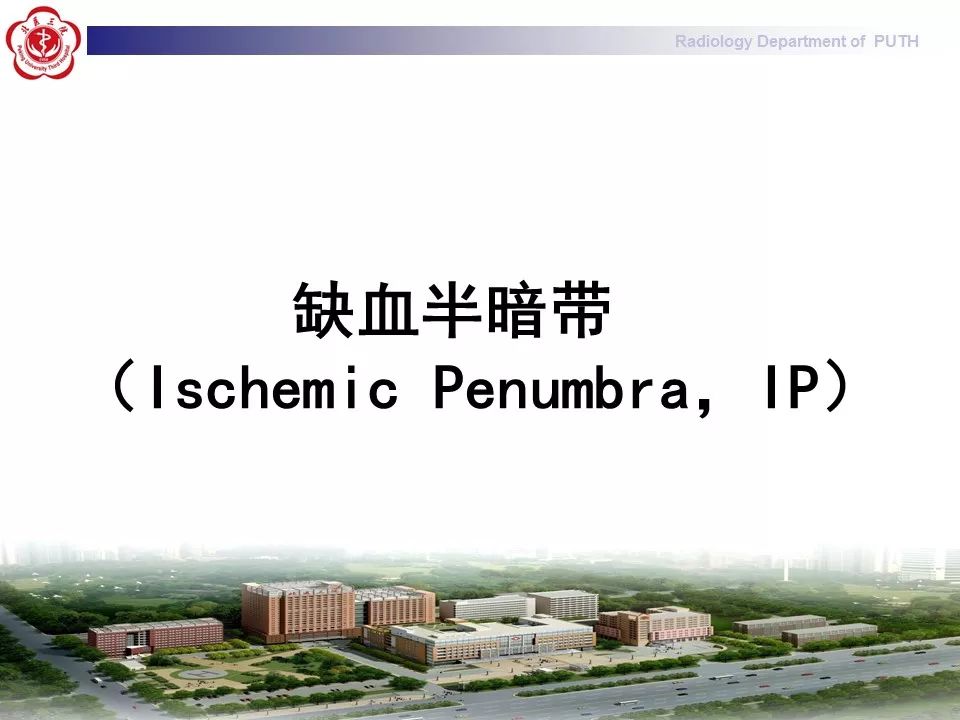 【PPT】脑CT灌注成像