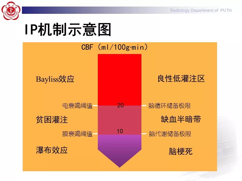 【PPT】脑CT灌注成像