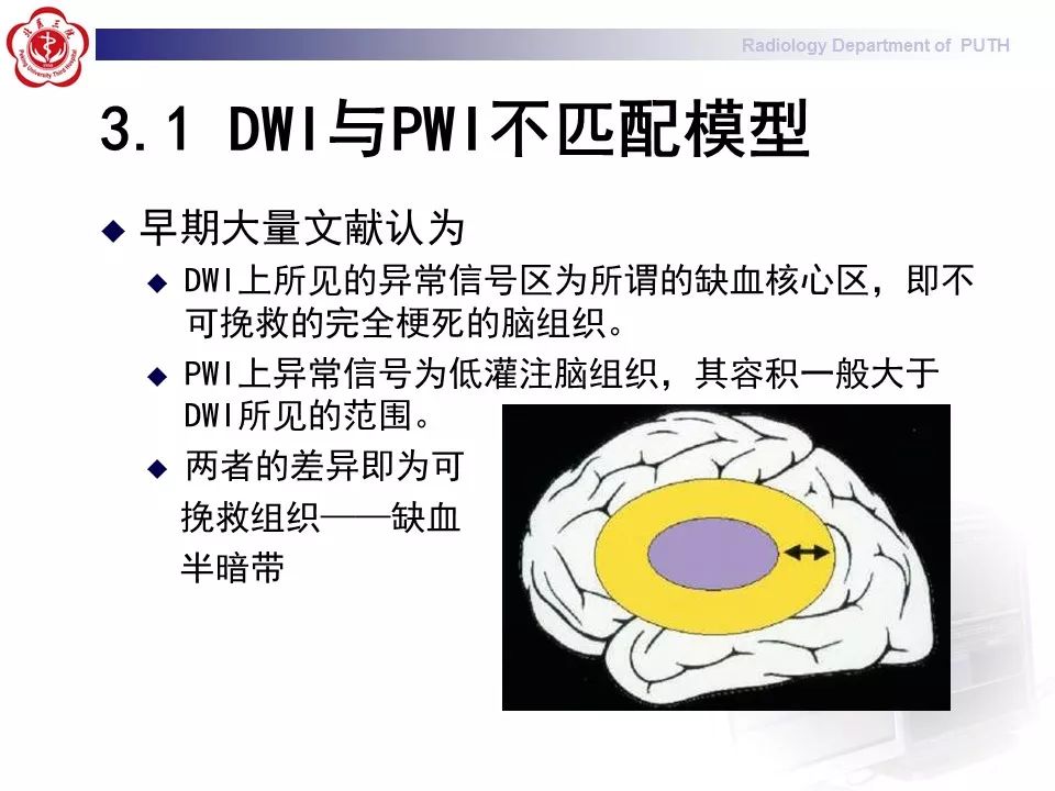 【PPT】脑CT灌注成像