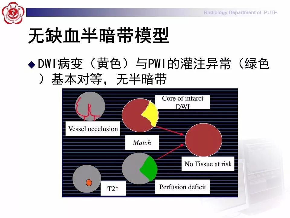 【PPT】脑CT灌注成像