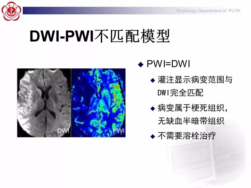【PPT】脑CT灌注成像