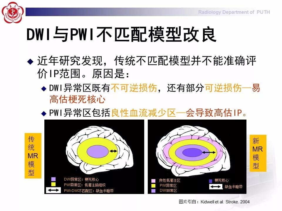【PPT】脑CT灌注成像