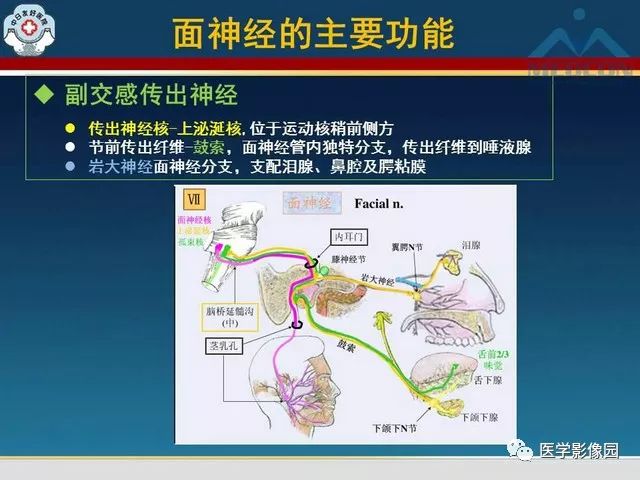 【PPT】面神经病变的影像