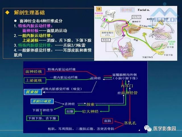 【PPT】面神经病变的影像
