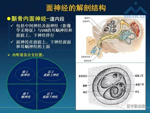 【PPT】面神经病变的影像
