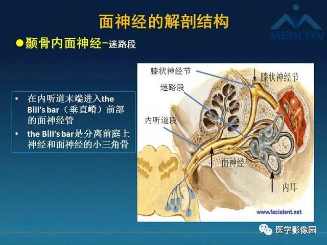 【PPT】面神经病变的影像