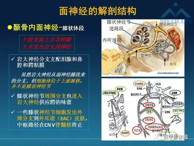 【PPT】面神经病变的影像