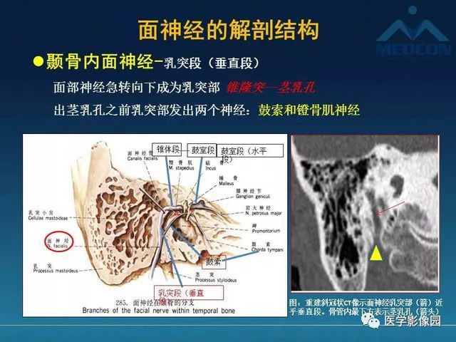 【PPT】面神经病变的影像