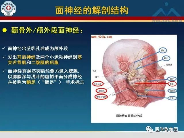 【PPT】面神经病变的影像