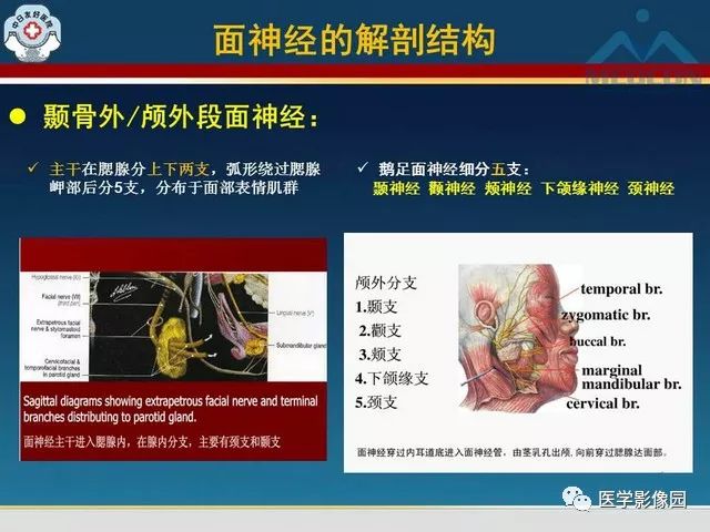 【PPT】面神经病变的影像