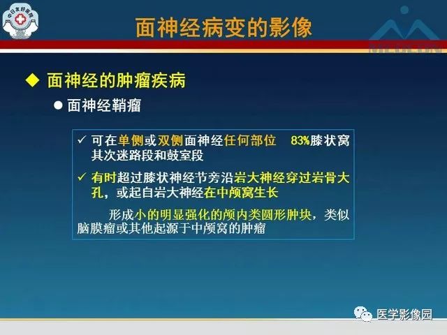【PPT】面神经病变的影像