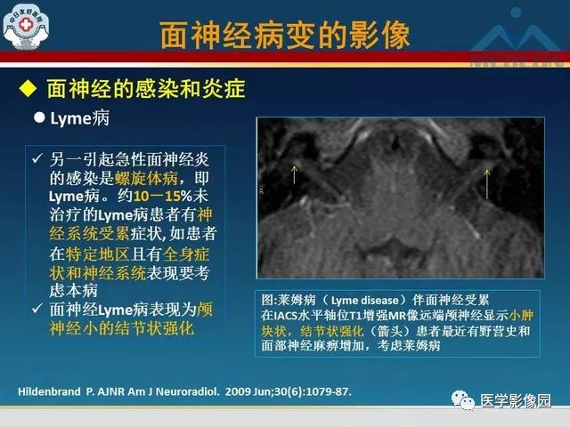【PPT】面神经病变的影像