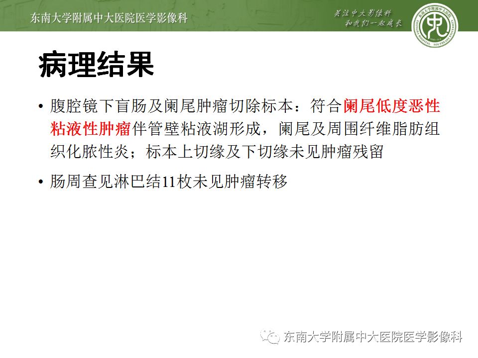 【病例】阑尾黏液性肿瘤1例CT影像表现