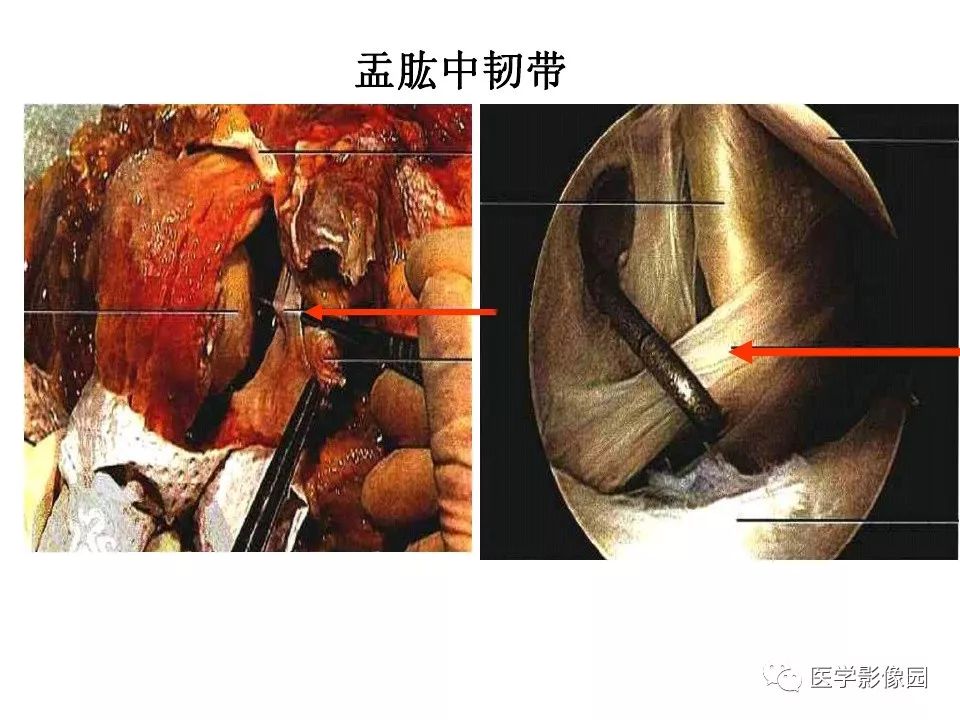 【PPT】肩关节韧带及损伤MR表现