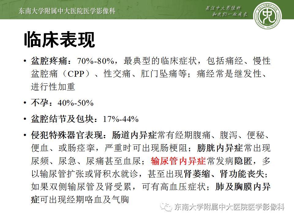 【病例】输尿管子宫内膜异位症1例CT