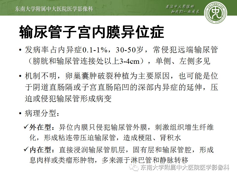 【病例】输尿管子宫内膜异位症1例CT