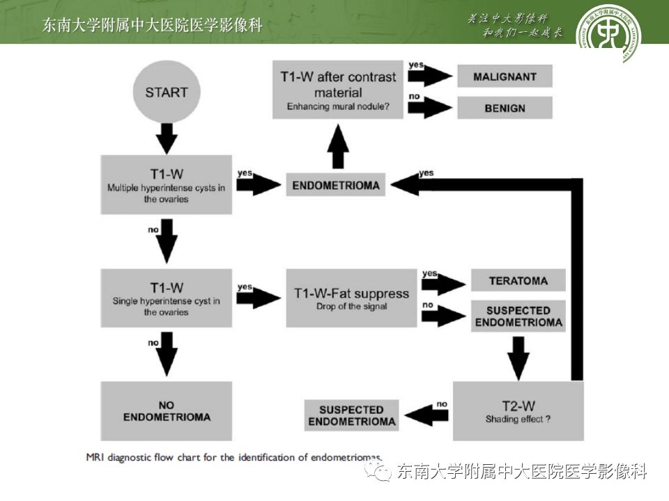 【病例】输尿管子宫内膜异位症1例CT