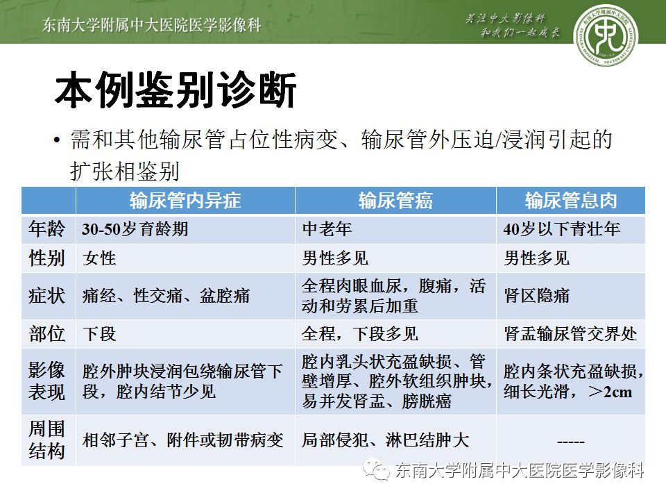 【病例】输尿管子宫内膜异位症1例CT