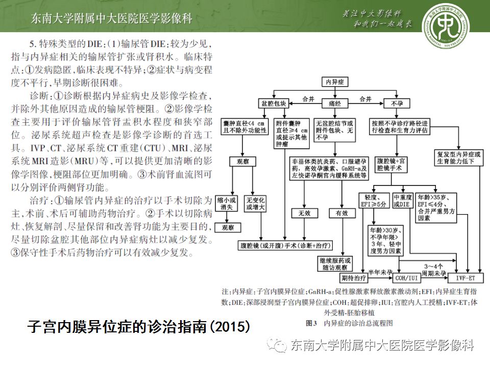 【病例】输尿管子宫内膜异位症1例CT