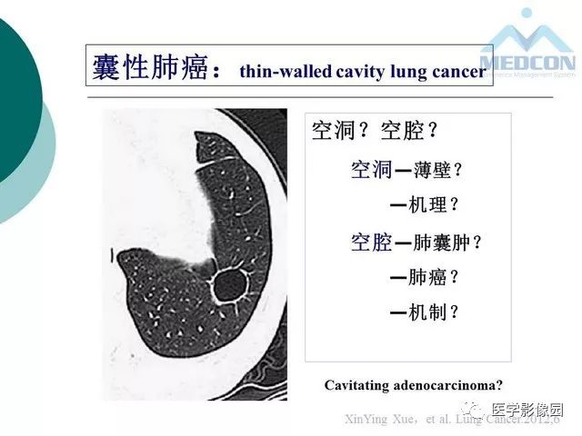 【PPT】囊性肺癌与肺癌伴空腔的CT征象诊断探讨