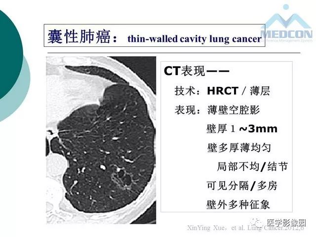 【PPT】囊性肺癌与肺癌伴空腔的CT征象诊断探讨