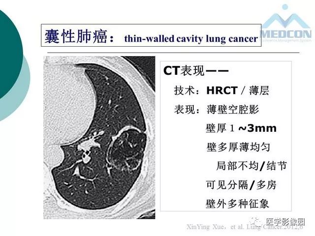 【PPT】囊性肺癌与肺癌伴空腔的CT征象诊断探讨
