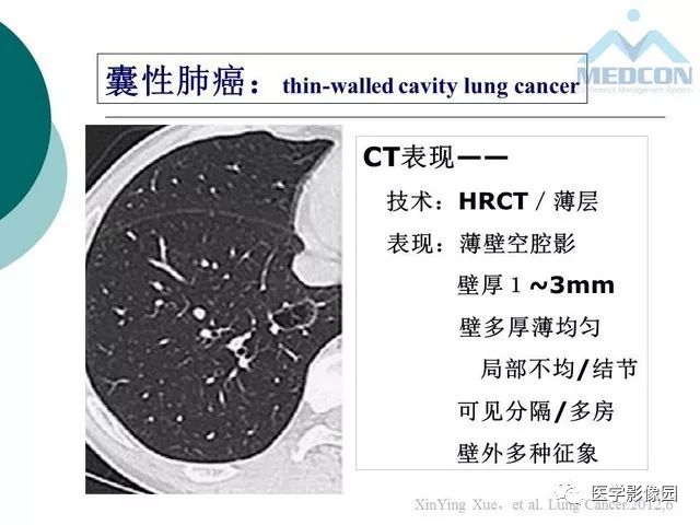 【PPT】囊性肺癌与肺癌伴空腔的CT征象诊断探讨