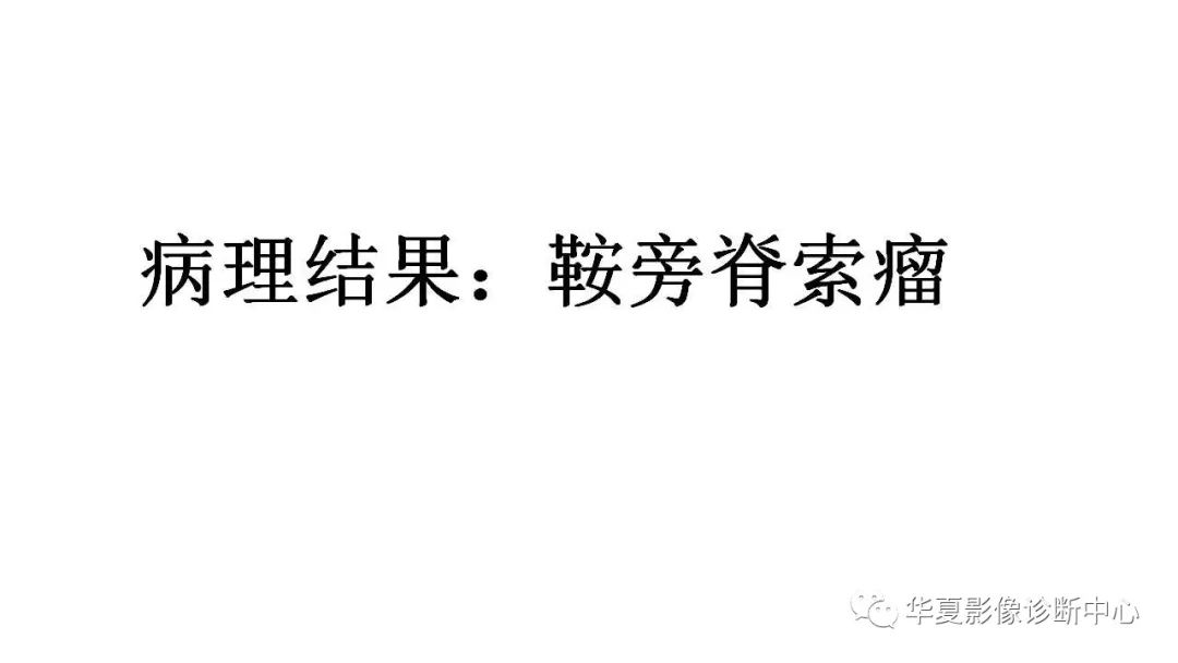 【病例】鞍旁脊索瘤1例CT及MR