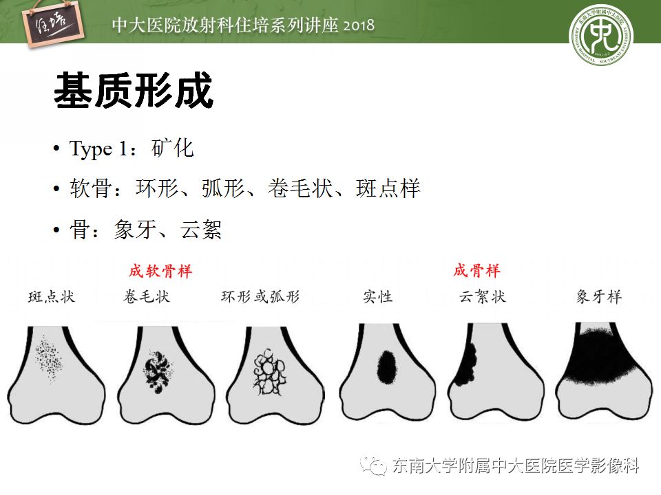 【PPT】骨肿瘤及类肿瘤病变的影像诊断思路