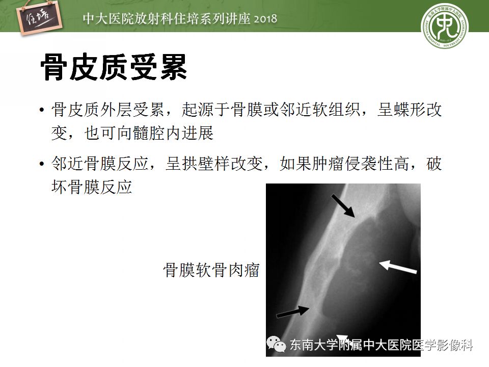 【PPT】骨肿瘤及类肿瘤病变的影像诊断思路