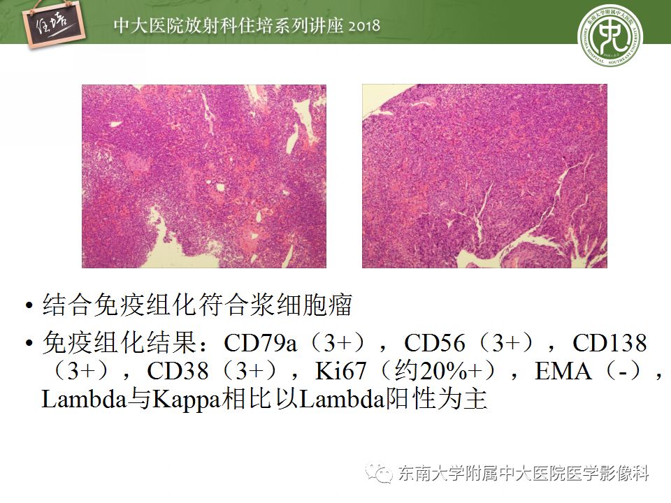 【PPT】骨肿瘤及类肿瘤病变的影像诊断思路