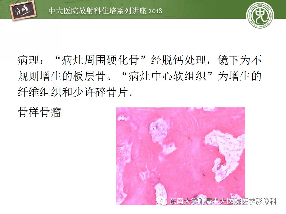 【PPT】骨肿瘤及类肿瘤病变的影像诊断思路