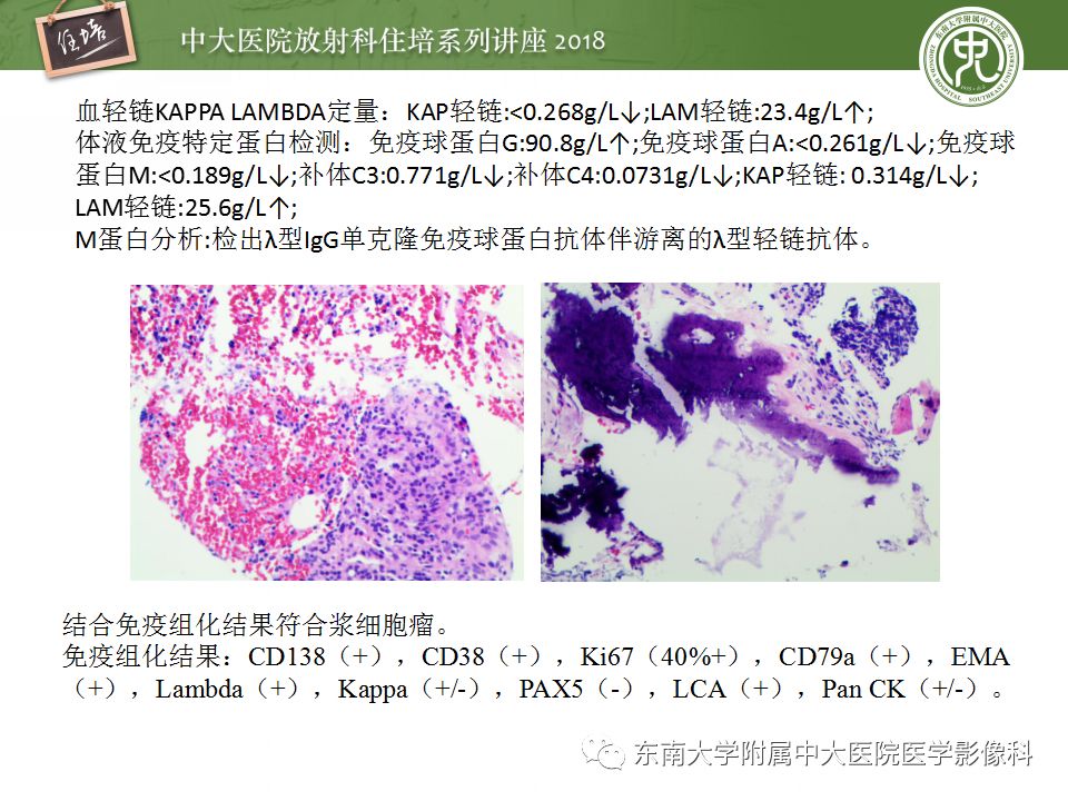 【PPT】骨肿瘤及类肿瘤病变的影像诊断思路