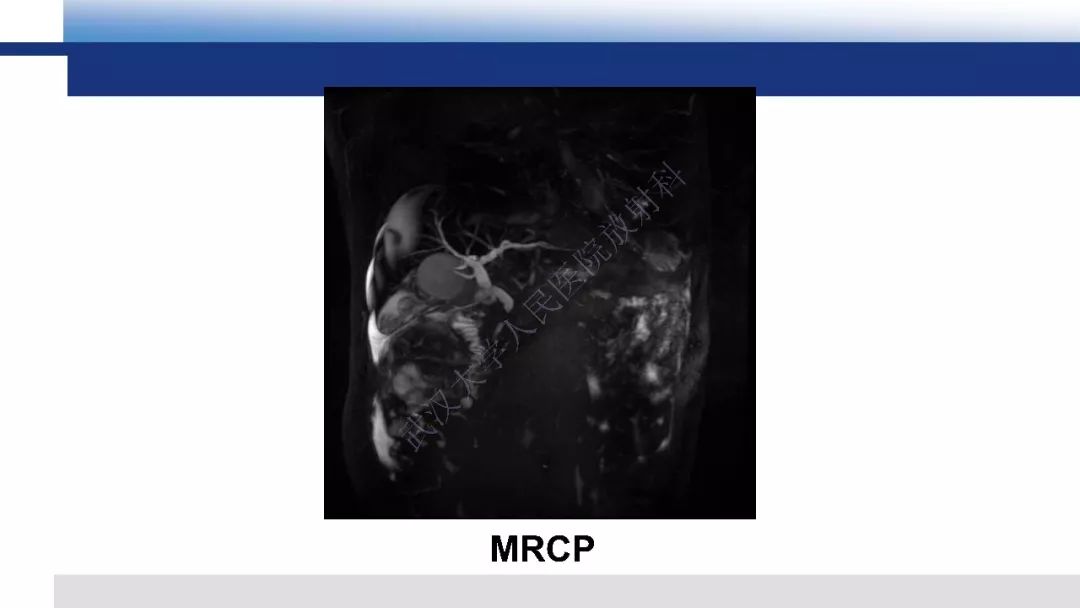 【PPT】胰腺癌与肿块型胰腺炎影像诊断