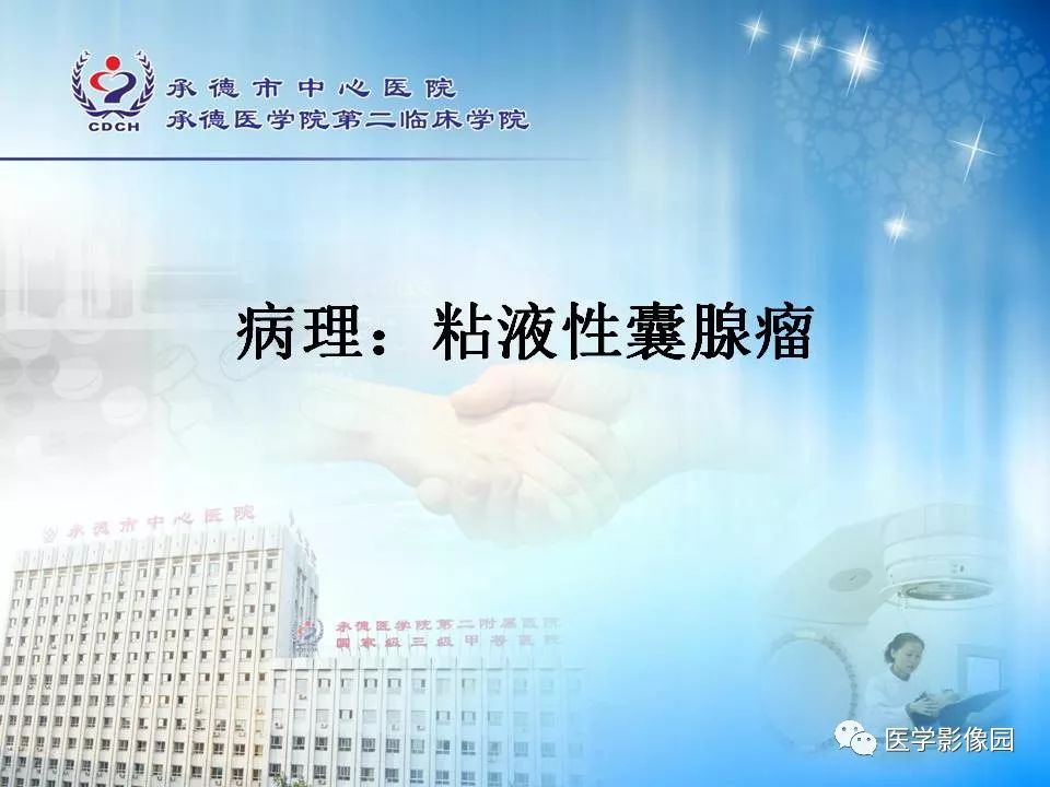 【病例】卵巢粘液性囊腺瘤1例CT影像表现